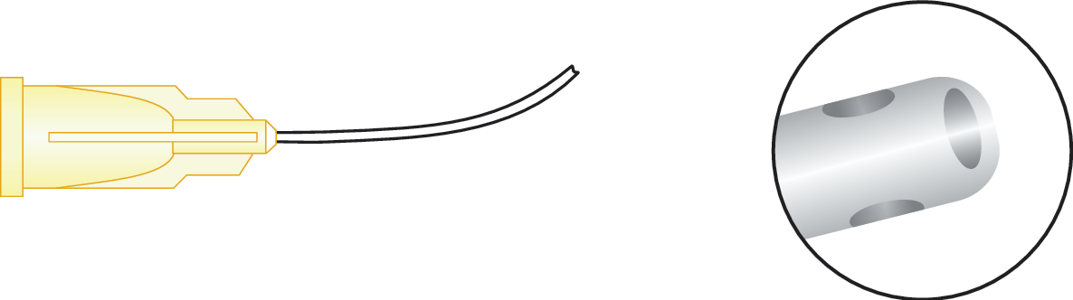 Subtenon's Anesthesia Cannula (Triport) (Curved)